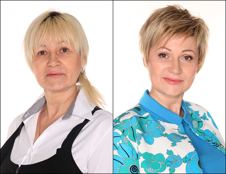 Косметология: БОИШЬСЯ ГИАЛУРОНКИ — ИДИ К СТИЛИСТУ